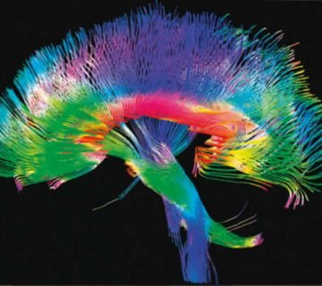 Human Connectome Project